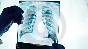 X-ray of the lungs to look at the light,the doctor is carefully examining the diagnosis,close-up