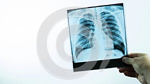 X-ray of a man in the hands of a doctor on a white background,a medical worker examines a lung disease,a snapshot of pulmonary ede