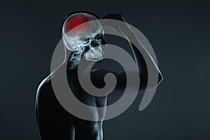 X-ray of a man& x27;s head. Cerebral stroke. Brain damage is highlighted by red colour.