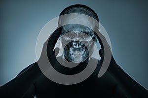 X-ray of a man& x27;s head. Medical examination of head injuries.