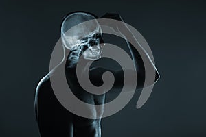 X-ray of a man& x27;s head. Medical examination of head injuries.
