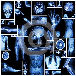 X-ray multiple part of human