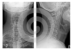 X-ray neck images