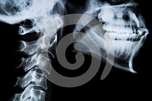X ray neck and Jaw