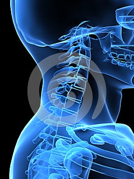 X-ray neck side