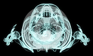 X-ray over head full body
