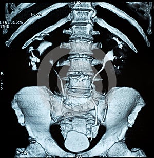 X-ray of the pelvis and spinal column