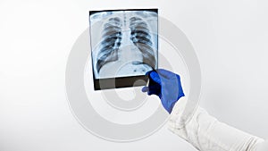 An x-ray of a person`s lungs in the doctor`s hands on a white background,make a diagnosis,the doctor looks at the x-ray and makes