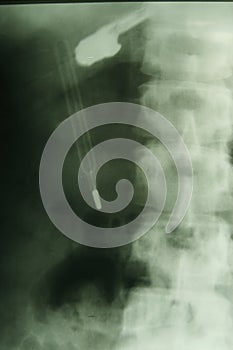 X-ray photo & thermometer