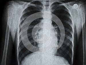 X-ray picture