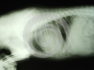 X-ray picture of dilated hearth