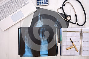 X-ray with pills and notepads on table