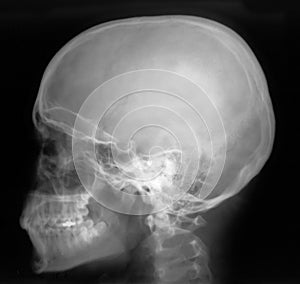 X-Ray Profile