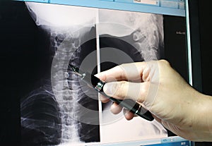 X-ray radiography