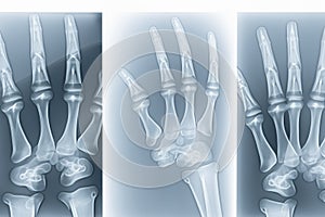 X-ray. X-ray of head, foot, head, mouth, ribs and hands. Bone scan. Body injury. X-ray analysis of human teeth.