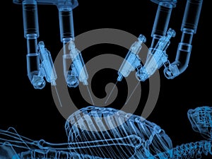 X-ray robotic assisted surgery in operating room