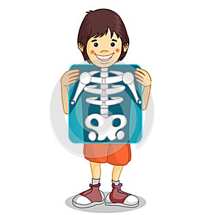 X-ray, Roentgen. RÃÂ¶ntgen film. Xray shows the breast, ribs, spine, and pelvis bones. Cartoon body x ray of child boy character.
