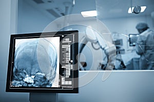 X-ray scan of the patients brain during surgery