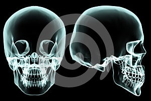 X-ray skull