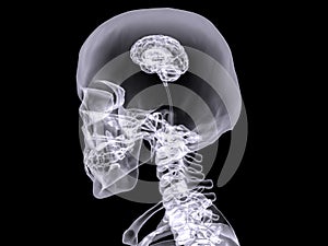 X-ray small brain