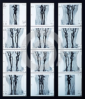 X-ray veins collection