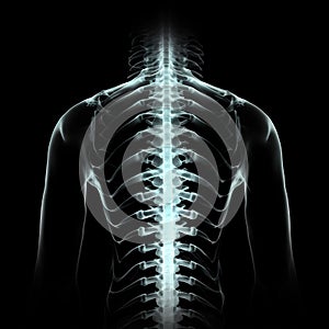 A X-ray view of a human torso highlighting the spinal column and rib cage. portrays a clinical and anatomical study