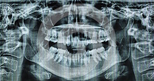 X ray of a womans mouth in 360 rotation
