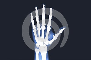 X-rayed human hand.