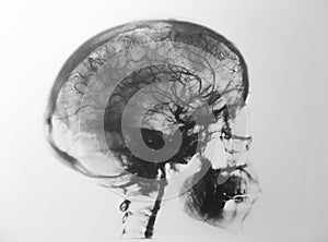 X-rays head