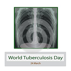 X-rays of light. Diagnosis of tuberculosis. Vector illustration on isolated background