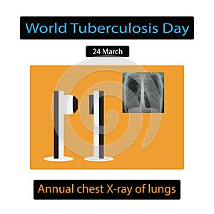 X-rays of light. Diagnosis of tuberculosis. Vector illustration on isolated background