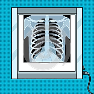 Xray chest in negatoscope pop art vector