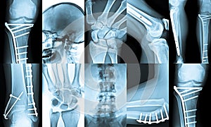 Xray Collage