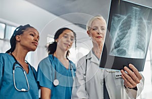 Xray, doctor and nurses, team and medicine with analysis of lung scan and cardiology medical group. Surgeon