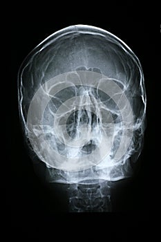 Xray/Face Front