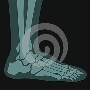 Xray of foot, joints and bones roentgen scans
