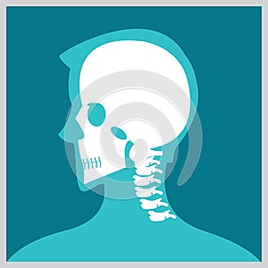 Xray of head and neck.