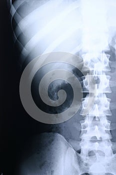 Xray/spine 2