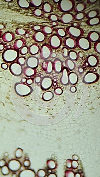 Xylem and other tissues of beet root under a microscope