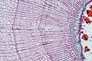 Xylem is a type of tissue in vascular plants that transports water and some nutrients photo