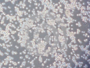 Yeast cells