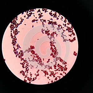 yeast cells in gram stain fine with microscope.