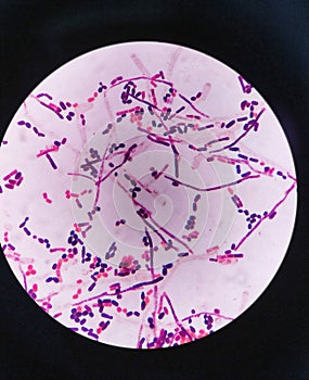 yeast cells and hyphae in gram stain fine with microscope.