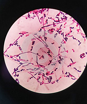 yeast cells and hyphae in gram stain fine with microscope.