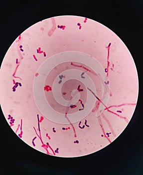 yeast cells and hyphae in gram stain fine with microscope.