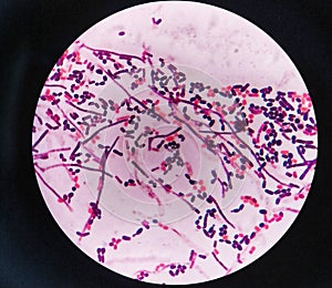 yeast cells and hyphae in gram stain fine with microscope.