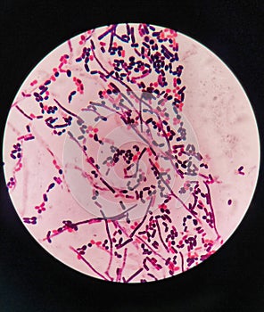 yeast cells and hyphae in gram stain fine with microscope.