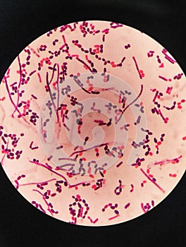 yeast cells and hyphae in gram stain fine with microscope.
