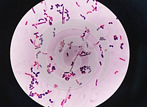 yeast cells and hyphae in gram stain fine with microscope.