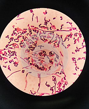 yeast cells and hyphae in gram stain fine with microscope.